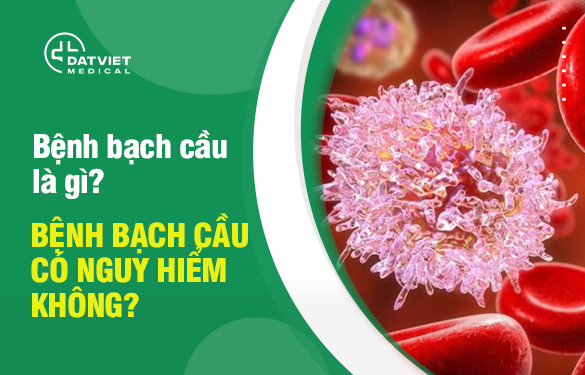 tim-hieu-benh-bach-cau-la-gi.jpg